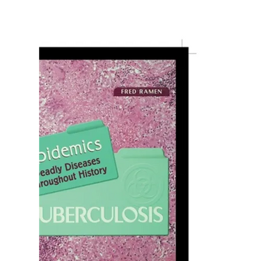 Tuberculosis