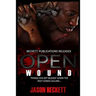 Open Wound 1