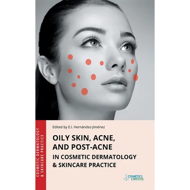Oily Skin, Acne, and Post-Acne in Cosmetic Dermatology & Skincare Practice