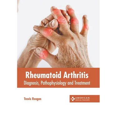 Rheumatoid Arthritis: Diagnosis, Pathophysiology and Treatment
