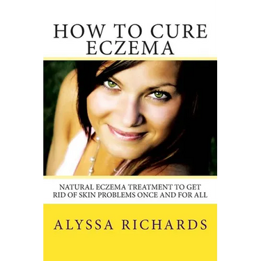 How To Cure Eczema: Natural Eczema Treatment To Get Rid Of Skin Problems Once And For All