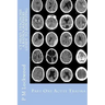 CT Head: DIAGNOSIS A Radiographers Guide To Reporting Part 1 Acute Trauma: Part One Acute Trauma