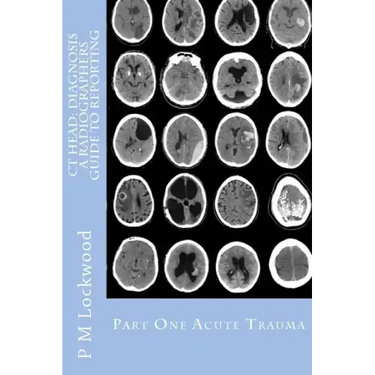 CT Head: DIAGNOSIS A Radiographers Guide To Reporting Part 1 Acute Trauma: Part One Acute Trauma