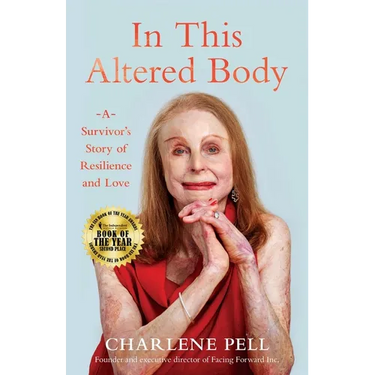 In This Altered Body: A Survivor's Story of Resilience and Love