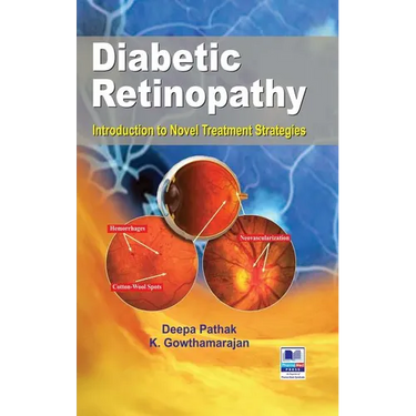 Diabetic Retinopathy: Introduction to Novel Treatment Strategies