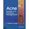 Acne: Causes and Practical Management