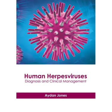 Human Herpesviruses: Diagnosis and Clinical Management