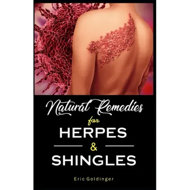 Natural Remedies For HERPES & SHINGLES: The Complete Guide