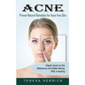 Acne: Proven Natural Remedies for Acne-free Skin (Learn About the Most Recent Updated Natural Acne)
