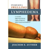 It's Not Just a Swelling! Lymphedema: Causes, Prevention, Treatment, Self-Management