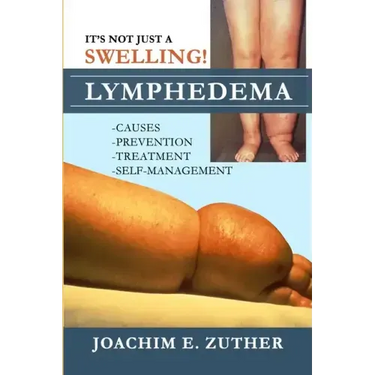 It's Not Just a Swelling! Lymphedema: Causes, Prevention, Treatment, Self-Management