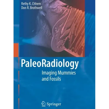 Paleoradiology: Imaging Mummies and Fossils
