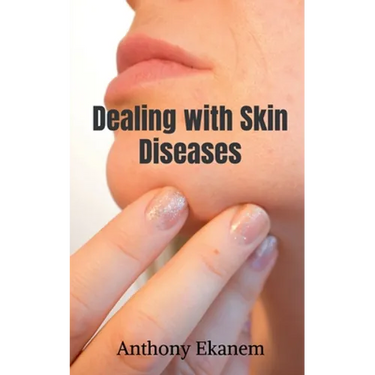 Dealing with Skin Diseases