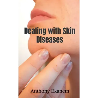 Dealing with Skin Diseases