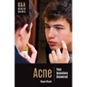 Acne: Your Questions Answered