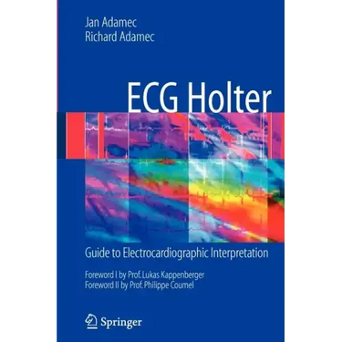 ECG Holter: Guide to Electrocardiographic Interpretation
