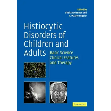 Histiocytic Disorders of Children and Adults: Basic Science, Clinical Features and Therapy