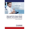Bone Graft for Future Dental Implants, the Truthful Reality
