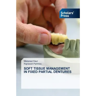 Soft Tissue Management in Fixed Partial Dentures