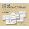 ECG and Intracardiac Tracings: A Toolkit Approach for Analyzing Arrhythmias