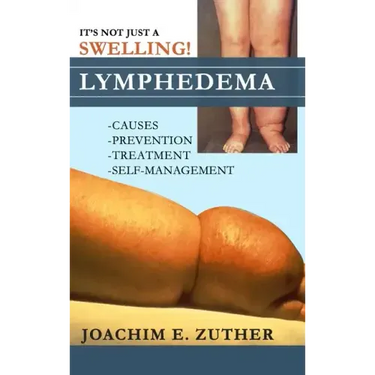 It's Not Just a Swelling! Lymphedema: Causes, Prevention, Treatment, Self-Management