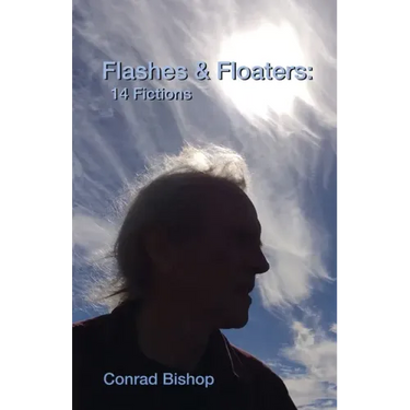 Flashes & Floaters