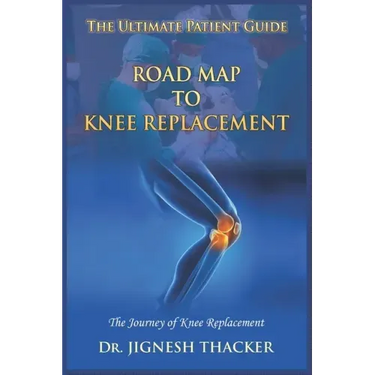 Road Map to Knee Replacement: The Journey Of Knee Replacement, Ultimate Patient Guide