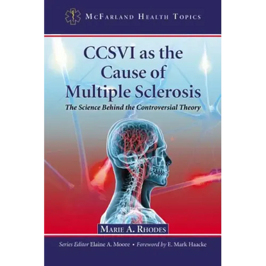 CCSVI as the Cause of Multiple Sclerosis: The Science Behind the Controversial Theory