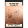 Understand Shingles: Everything You Should Know About Shingles: Shingles Topical Treatment