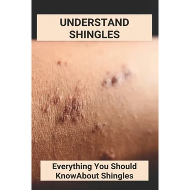 Understand Shingles: Everything You Should Know About Shingles: Shingles Topical Treatment