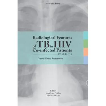 Radiological features of TB in HIV Co-infected Patients. Case book