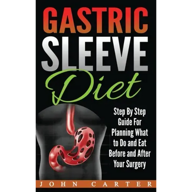 Gastric Sleeve Diet: Step By Step Guide For Planning What to Do and Eat Before and After Your Surgery