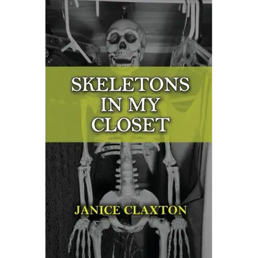 Skeletons in My Closet