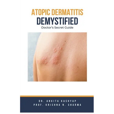 Atopic Dermatitis Demystified: Doctor's Secret Guide