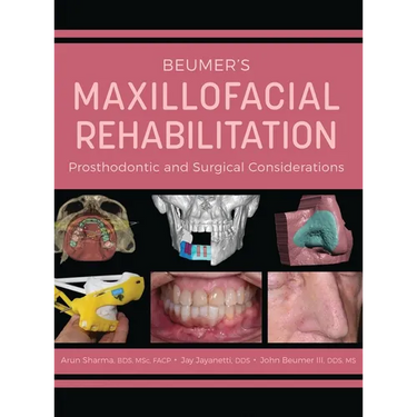 Beumer's Maxillofacial Rehabilitation: Prosthodontics and Surgical Considerations