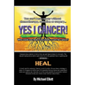 Yes I Cancer: You can't beat cancer without chemotherapy, radiation or surgery