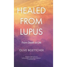 Healed from Lupus: From Death to Life