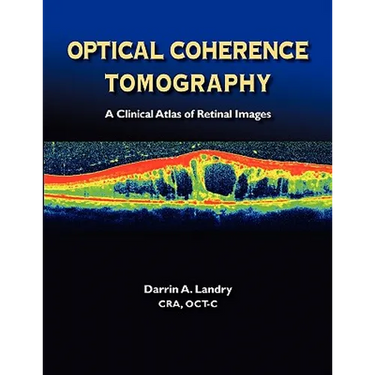 Optical Coherence Tomography a Clinical Atlas of Retinal Images