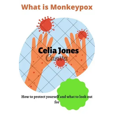 What Is Monkeypox: How to protect yourself and what to look out for. Guidelines for safety
