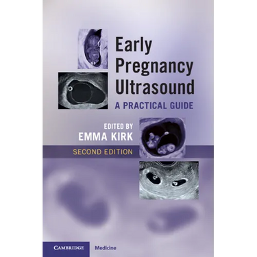 Early Pregnancy Ultrasound: A Practical Guide