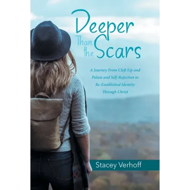 Deeper Than the Scars: A Journey from Cleft Lip and Palate and Self-Rejection to Re-Established Identity Through Christ
