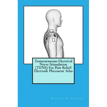 Transcutaneous Electrical Nerve Stimulation (TENS) For Pain Relief: Electrode Placement Atlas