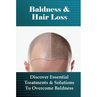 Baldness & Hair Loss: Discover Essential Treatments & Solutions To Overcome Baldness: How To Prevent Hair Loss For Guys