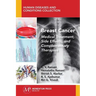 Breast Cancer: Medical Treatment, Side Effects, and Complementary Therapies