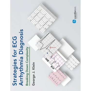 Strategies for ECG Arrhythmia Diagnosis: Breaking Down Comlexity: Breaking Down Complexity