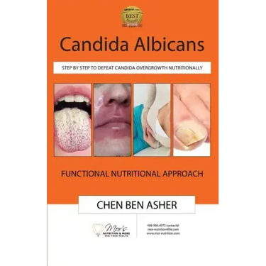 Candida Albicans: Step by Step to Defeat Candida Overgrowth Nutritionally