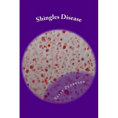 Shingles Disease: The Complete Guide