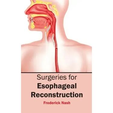 Surgeries for Esophageal Reconstruction