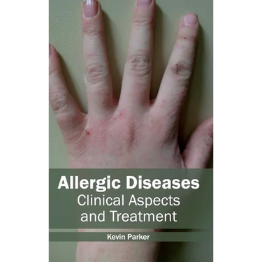 Allergic Diseases: Clinical Aspects and Treatment