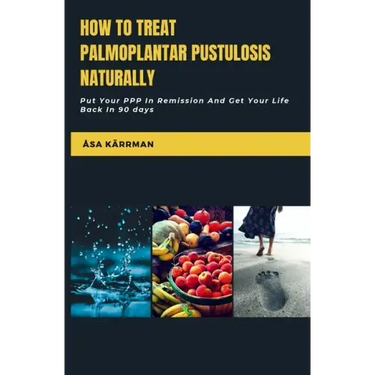 How To Treat Palmoplantar Pustulosis Naturally: Put Your PPP In Remission And Get Your Life Back In 90 Days